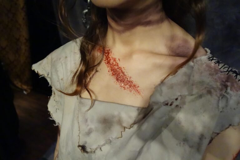 The Shocking Truth About Personal Injury Lawsuit Loans Most Attorneys Won’t Tell You